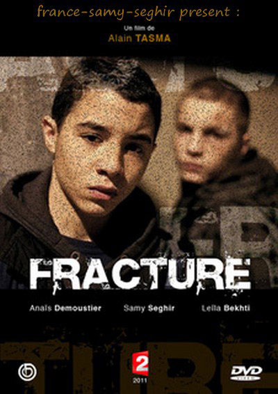 Fracture